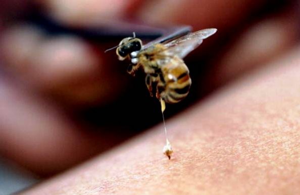 Tout savoir sur l’allergie au venin d’abeille